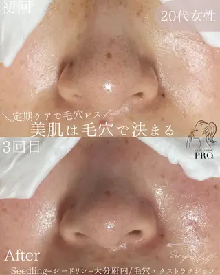 シードリン 府内店 小波のヘアスタイル