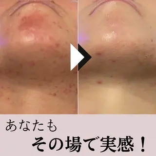 毛穴専門店Bébé 大阪中央店のエステ・リラクイメージ