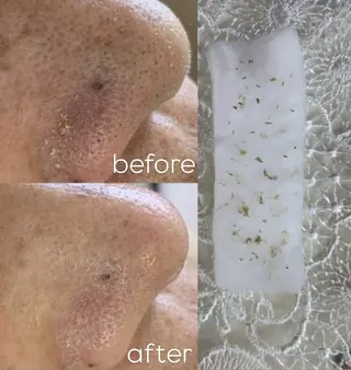 毛穴シミケアサロン Beau　堀口まひろのその他イメージ