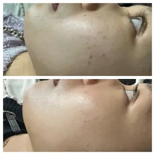 新宿大久保美容サロン BELL  マイのその他イメージ