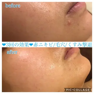 ミディアム カラー パーマ ヘアアレンジ キッズ ネイル マツエク・マツパ EnsorClair 代表 野口真央のエステ・リラクイメージ