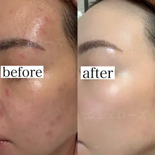 Nm'Rose(エミュローズ)所属・Nm'Rose .エミュローズのエステ・リラクイメージ