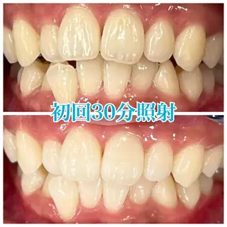 ホワイトニング🦷 ネイル💅LEAのその他イメージ