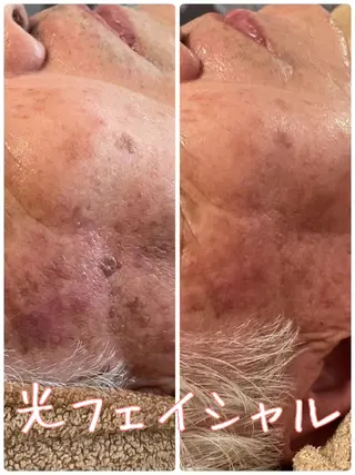 エステsala藤沢 sanaeのエステ・リラクイメージ