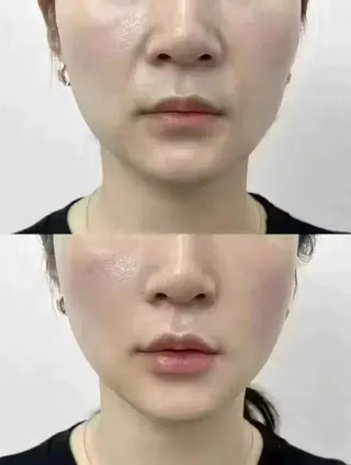 ネイル aliaハーブ水光店 エステティシャン募集のエステ・リラクイメージ