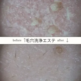 メンズ SKIN GYM所属・SKIN GYM メンズ専門脱毛サロンのエステ・リラクイメージ