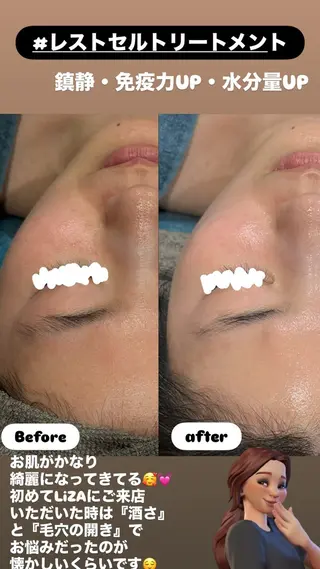 LiZA エステティックサロンのエステ・リラクイメージ