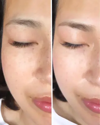 マツエク・マツパ 医療提携美容サロン Beatriceのエステ・リラクイメージ