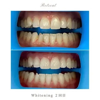 歯科医院提携 Retreatのエステ・リラクイメージ