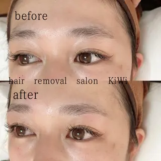 アイブロウ 脱毛サロン KiWiのエステ・リラクイメージ