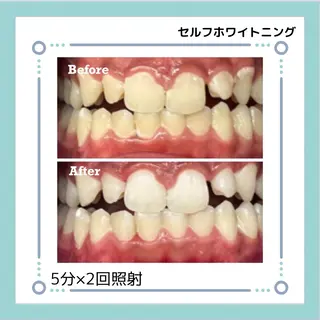 Nail salon Adorerのエステ・リラクイメージ