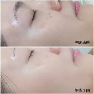 シミケア専門店 HAQUAのエステ・リラクイメージ