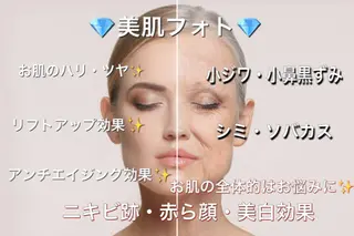 ロング カラー パーマ ヘアアレンジ メンズ キッズ ネイル マツエク・マツパ Chloe-クロエ- 脱毛/フェイシャルのエステ・リラクイメージ