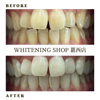 メンズ ホワイトニング ショップ葛西店のその他イメージ