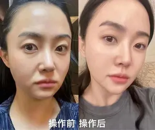 愛維美水光美肌専門店 メンズレディースokのエステ・リラクイメージ