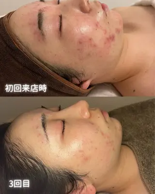 private beauty salon Lilby所属・リルビー 肌育・肌質改善サロンのその他イメージ