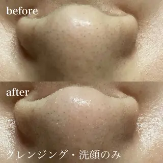 磐田｜LAYLA 一番丁寧な脱毛店のエステ・リラクイメージ