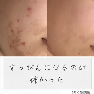 ニキビ経験者が施術 する専門サロン🌻のエステ・リラクイメージ