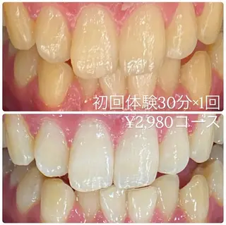 ホワイトニングルーム 横浜店のその他イメージ