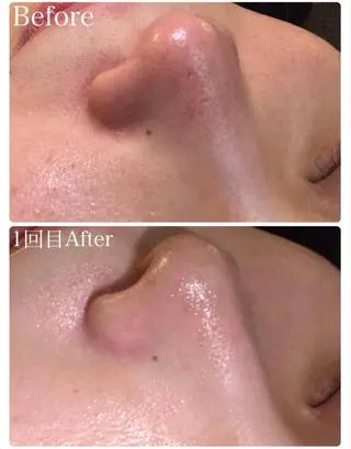 N_BLANC .ROPPONGIのエステ・リラクイメージ