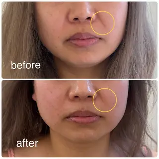 ほねつぎ一休さん 宇品店のエステ・リラクイメージ