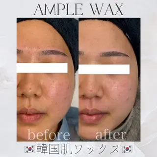 アイブロウ Lea堺東　毛穴洗浄 ×顔ワックス脱毛のその他イメージ