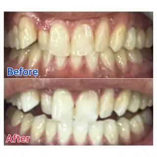 MBEAUTYSALON 千葉店・京成大久保所属・Melty 輝のその他イメージ