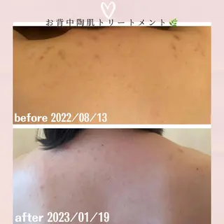 パーマ ヘアアレンジ ネイル マツエク・マツパ アイブロウ 3/25迄ハーブ ピーリングBloomのエステ・リラクイメージ