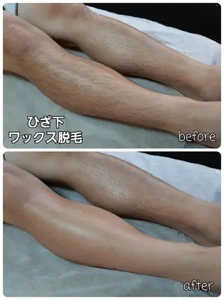 メンズ メンズ・脱毛サロン DEARS所属・山村幸久　メンズ脱毛 ディアーズのエステ・リラクイメージ