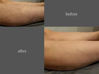 メンズ 脱毛サロン Terryのエステ・リラクイメージ