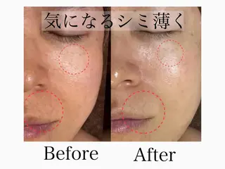 六本木/似合わせ眉毛 andＳ🍀Yuriのエステ・リラクイメージ