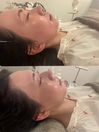 美容鍼灸サロン mahoroba院長のエステ・リラクイメージ
