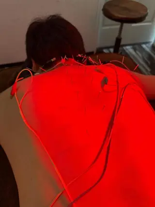 小顔矯/美容鍼/鍼灸 BeauJuのその他イメージ