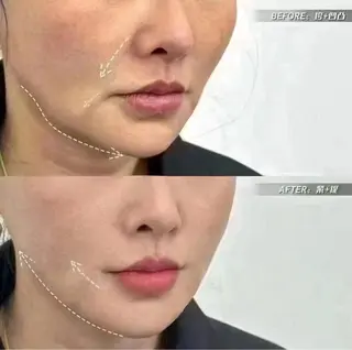 ネイル aliaハーブ水光店 エステティシャン募集のエステ・リラクイメージ