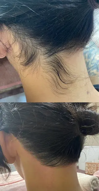 メンズ ビューティーサロン レビュールのエステ・リラクイメージ