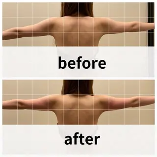 美容鍼/ヘッドスパ/ 💎さかもとのエステ・リラクイメージ