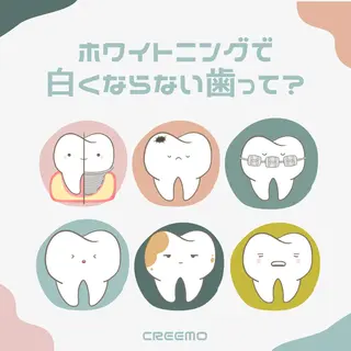 歯のホワイトニング HARU南浦和のその他イメージ