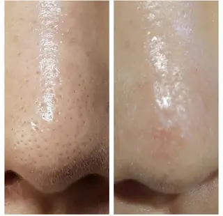 メンズ Epina 千葉店 【エピナ】のエステ・リラクイメージ