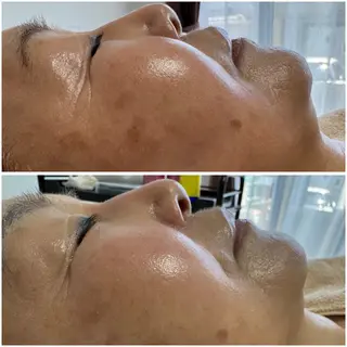 肌質改善サロン Manaririoのエステ・リラクイメージ