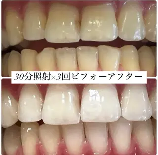 ホワイトニングルーム 横浜店のその他イメージ
