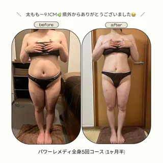 《本気痩せ×疲労改善 》  BILOOPのエステ・リラクイメージ