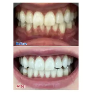 Ｍ渋谷 ホワイトニングのエステ・リラクイメージ