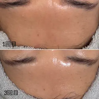 Éclat de Belle🫧白玉肌のその他イメージ