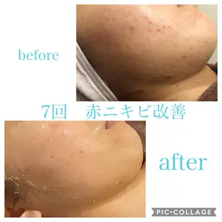 ロング カラー パーマ ヘアアレンジ メンズ ネイル マツエク・マツパ EnsorClair 代表 野口真央のエステ・リラクイメージ