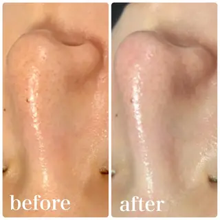 NAO 🌺のマツエク・マツパデザイン