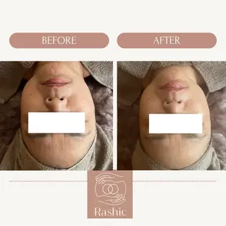 ReN エステサロンのエステ・リラクイメージ