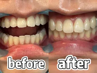 浮腫|肩こり|張り 日々の疲れを解消★のエステ・リラクイメージ