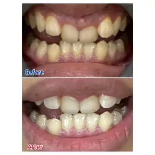 Ｍ渋谷 ホワイトニングのエステ・リラクイメージ