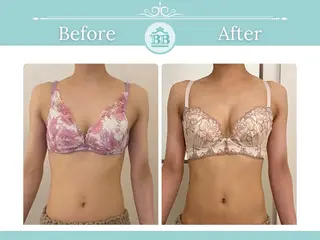 美人バスト北千住店所属・千葉 寧音のエステ・リラクイメージ