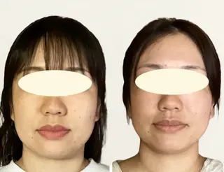 ルコナビューティ所属・小顔・歪み専門　井元 朋子のエステ・リラクイメージ